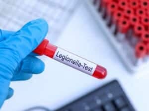 Sanificazione legionella Bergamo